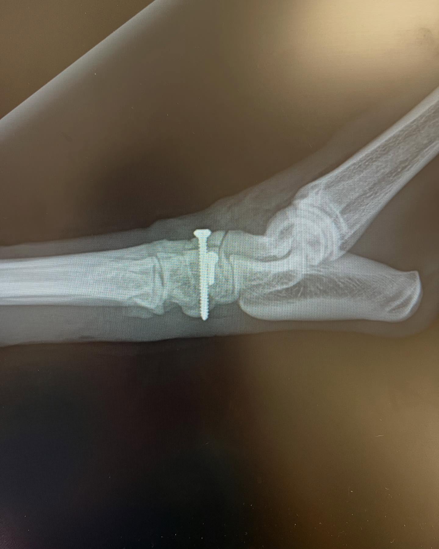 Orthopaedic x-ray